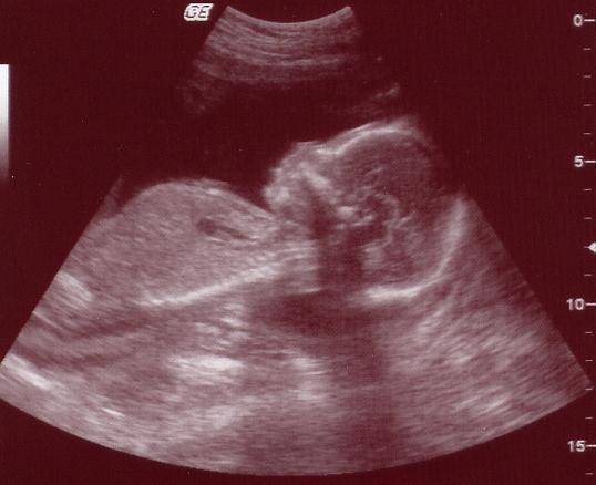 ultrasound unborn child
