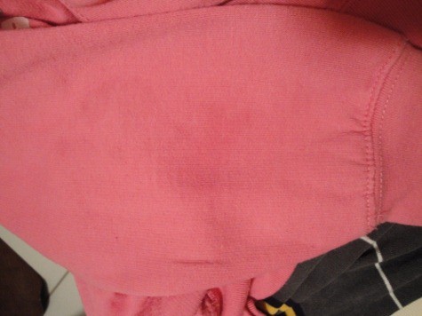 How to Get Grease Stains Out of Laundry