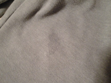 laundry grease stains treated