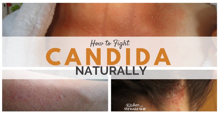 Facebook 3 Steps to Fighting Candida Naturally