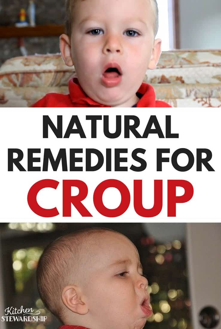 NATURAL REMEDIES FOR CROUP