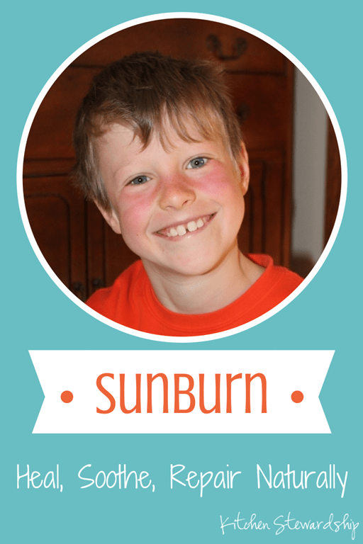 Treating a Sunburn Naturally: Heal and Soothe with One Easy Ingredient. Sunburns are sun damage, and you know once you get one that you've increased your risk of skin cancer. That stinks! How to relieve, heal and protect from sunburn, naturally.