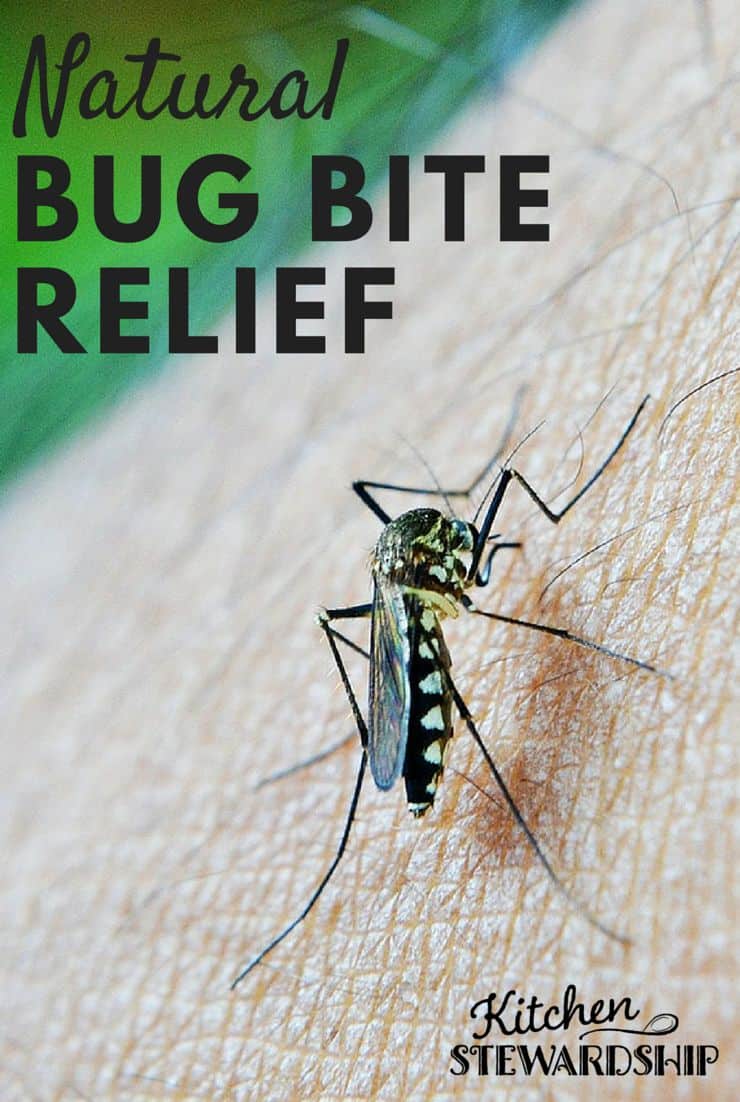 Natural Bug Bite Relief, home remedies for itchy bug bites
