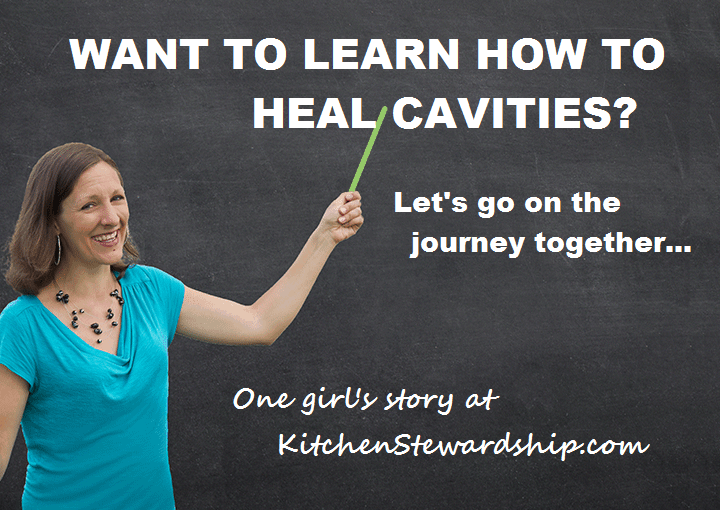 My Plan to Heal My Cavity (Ok, Fine, CavitieS!)