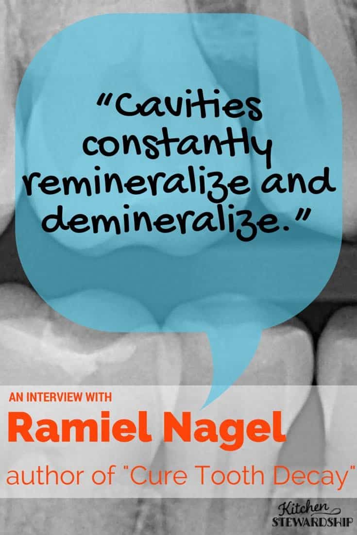 Cavities constantly remineralize and demineralize Ramiel Nagel author of Cure Tooth Decay