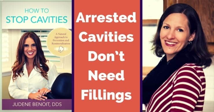 How to Stop Cavities interview with Dr Judene Benoit