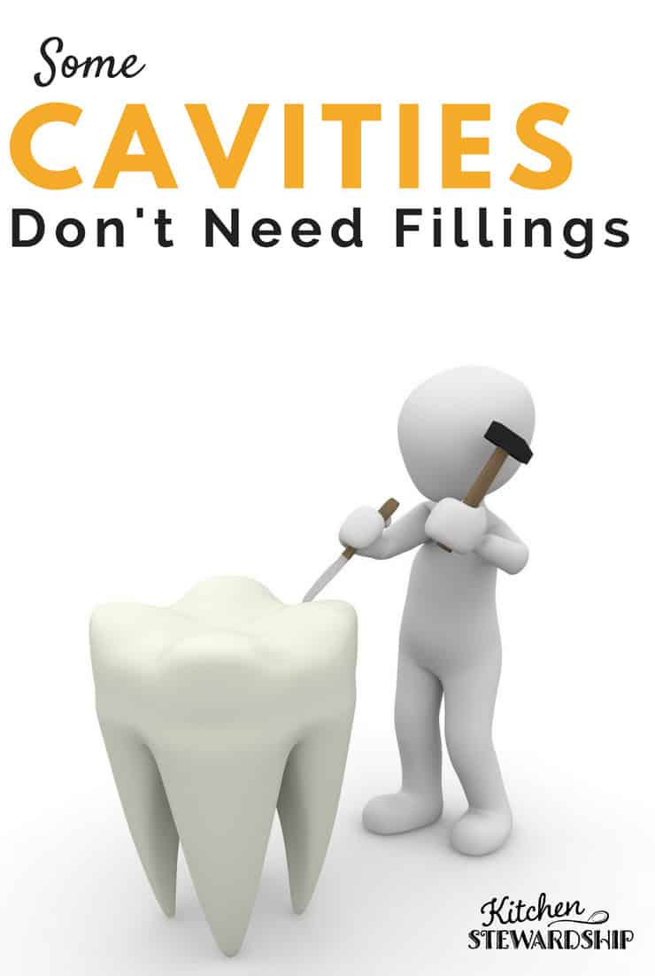 Some Cavities Dont need Fillings
