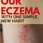 This one simple new habit healed our eczema!
