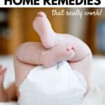 diaper rash home remedies that really work