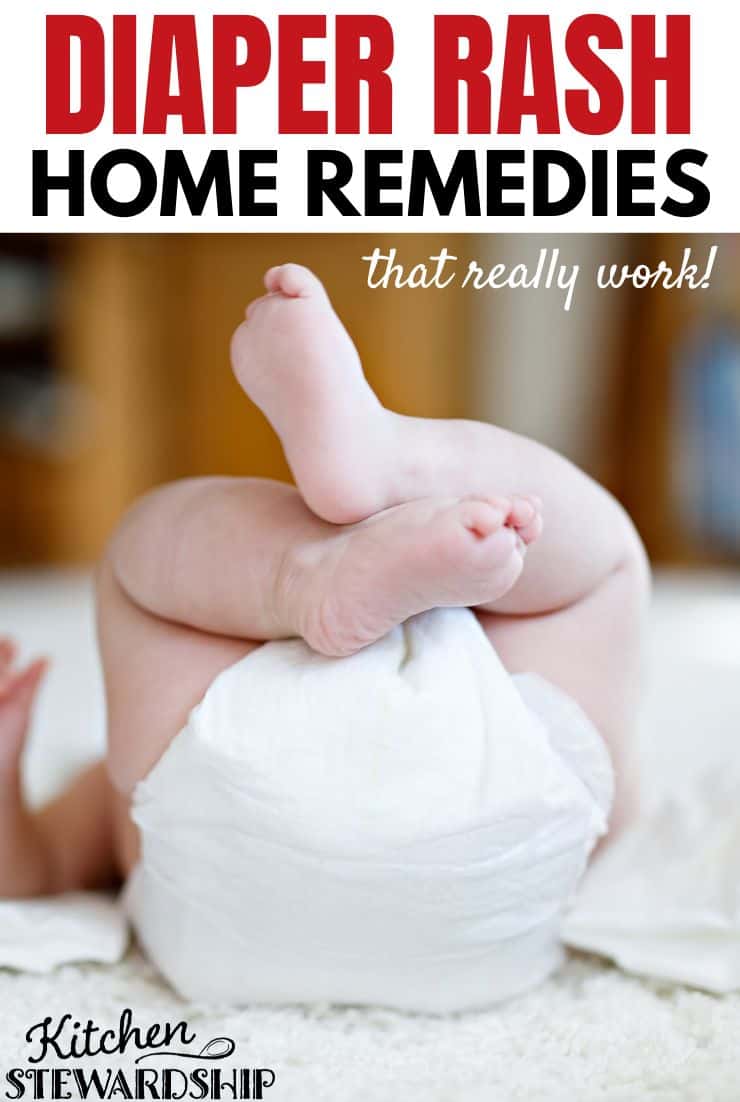 diaper rash home remedies