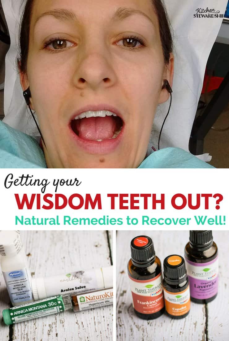 Essential oils, spices, homeopathy and salves are all part of natural pain relief options for wisdom teeth removal.