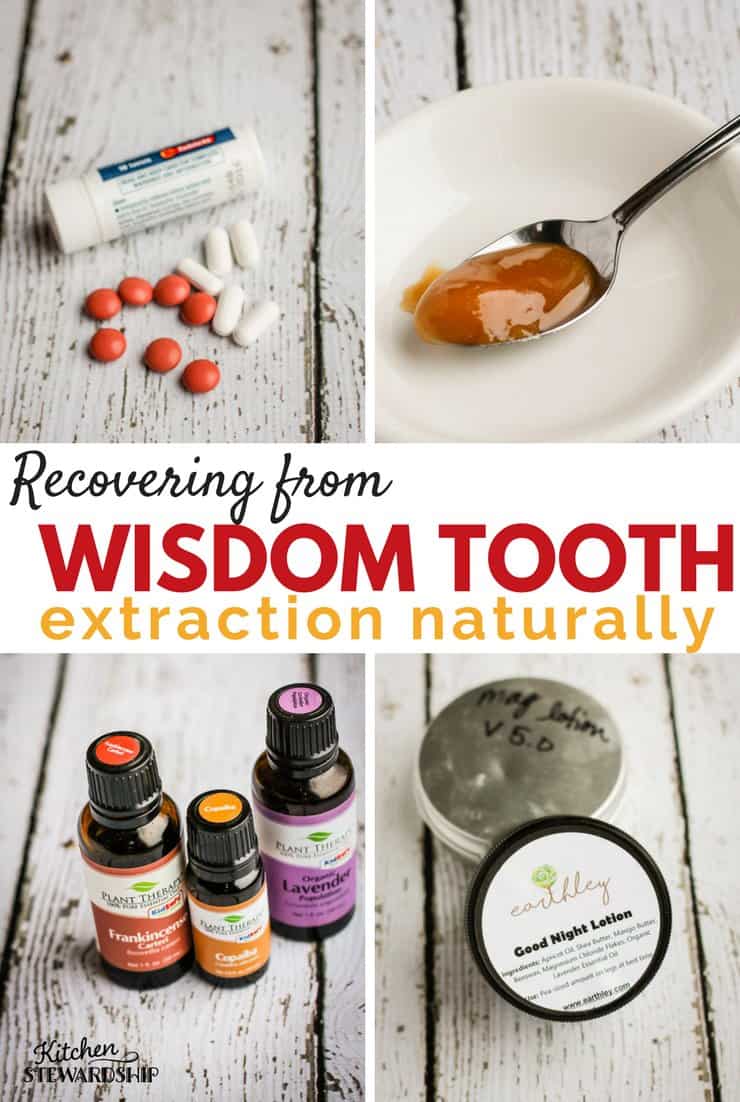 recovering from wisdom tooth removal naturally