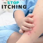 How to get a bug bite to stop itching.