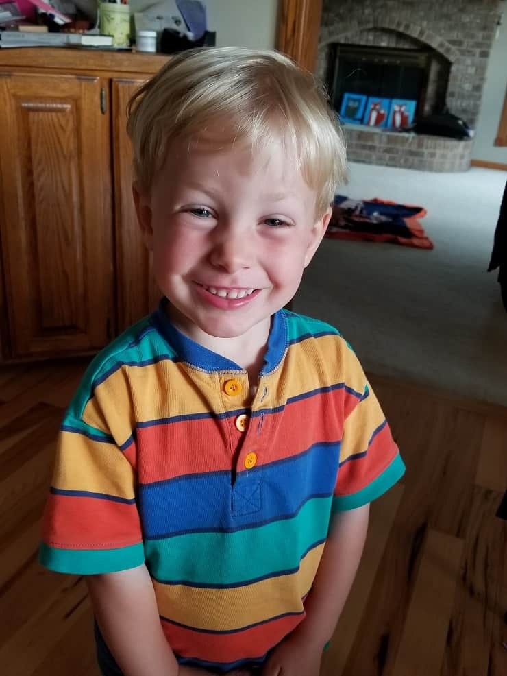 A boy with a concussion