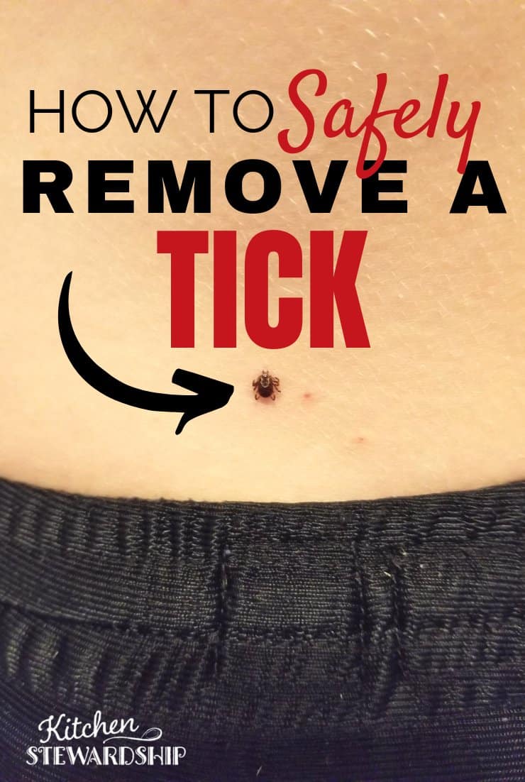 How to safely remove a tick