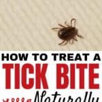 How to Treat a Tick Bite Naturally