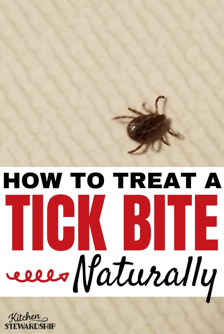 How to Treat a Tick Bite Naturally