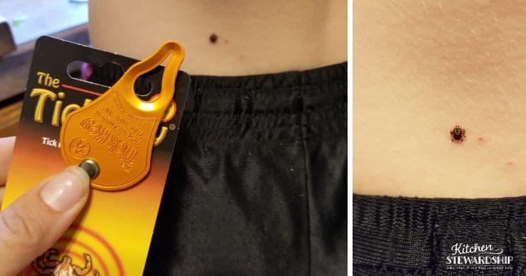 How to Remove a Dog Tick Using a Tick Key