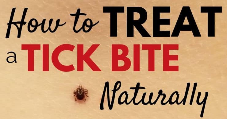 How to Treat a Tick Bite Naturally