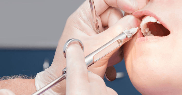 Dentist administering Novocain 