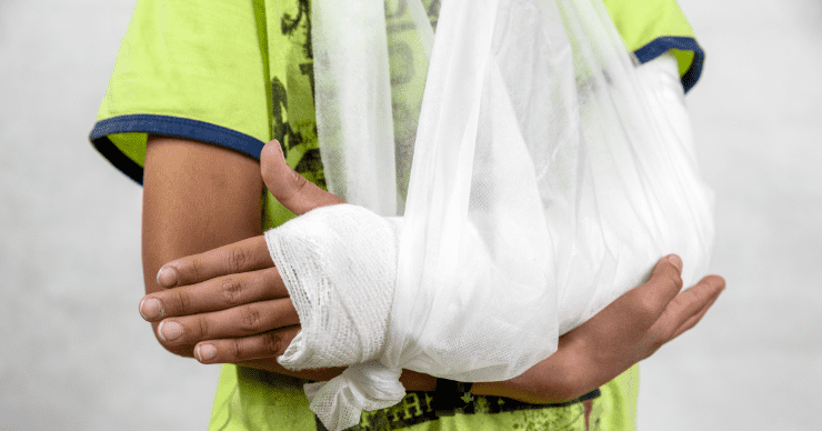 kid with broken arm